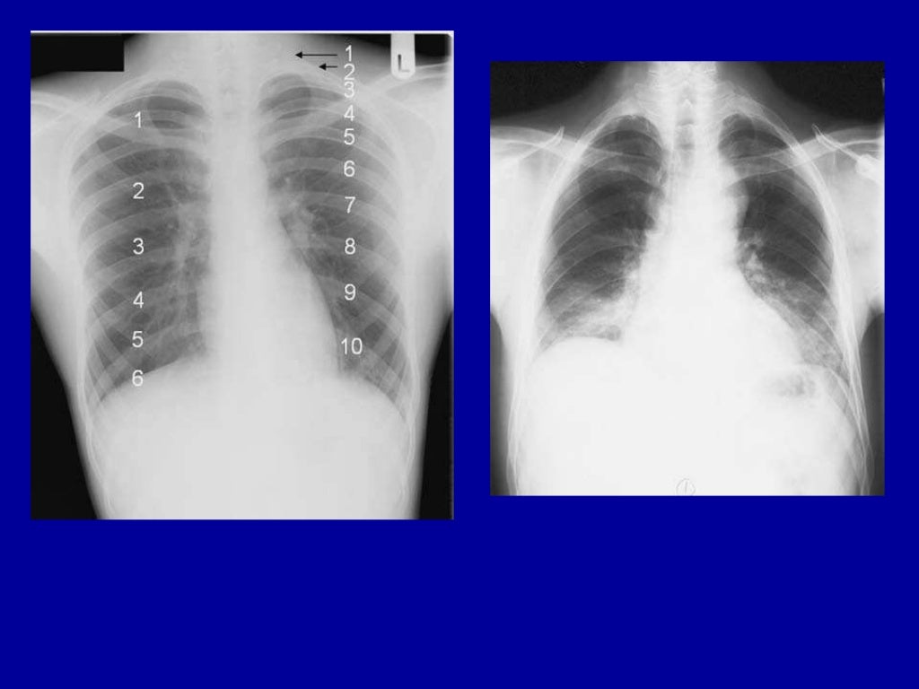 Basic radiology for non radiologist