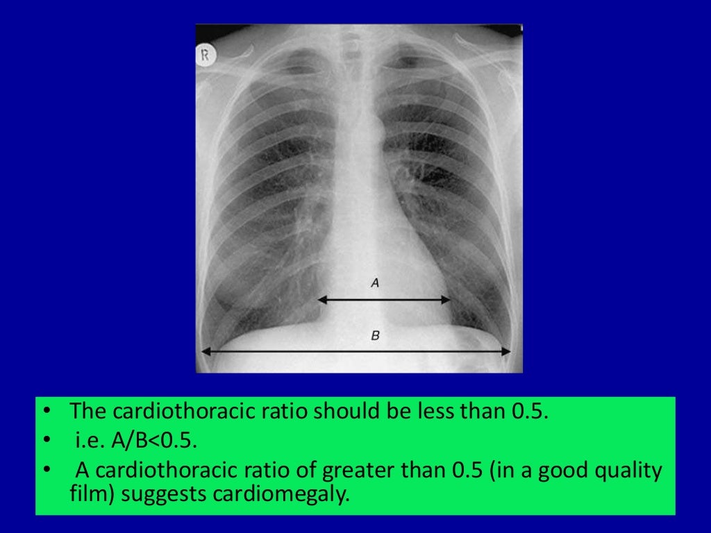 Basic radiology for non radiologist