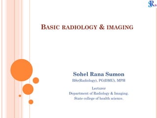 BASIC RADIOLOGY & IMAGING
Sohel Rana Sumon
BSc(Radiology), PG(DMU), MPH
Lecturer
Department of Radiology & Imaging.
State college of health science.
 