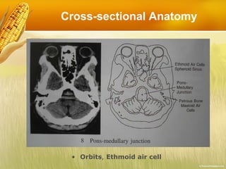 Cross-sectional Anatomy Orbits ,  Ethmoid air cell 