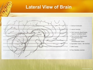 Lateral View of Brain 