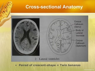Cross-sectional Anatomy Paired of crescent-shape = Twin bananas 