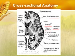 Cross-sectional Anatomy 