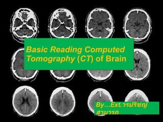 Basic Reading Computed Tomography  ( CT ) of Brain By…Ext. วรปรัชญ์ สามารถ 