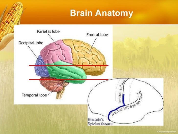 Basic reading computed tomography (ct) of brain