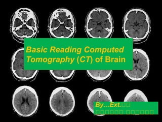 Basic Reading Computed
Tomography (CT) of Brain
Basic Reading Computed
Tomography (CT) of Brain
By…Ext.วว
วววววว วววววว
By…Ext.วว
วววววว วววววว
 