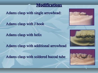 Basic removable appliance design | PPT