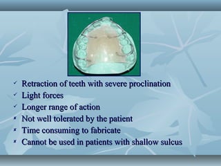  Retraction of teeth with severe proclinationRetraction of teeth with severe proclination
 Light forcesLight forces
 Longer range of actionLonger range of action
 Not well tolerated by the patientNot well tolerated by the patient
 Time consuming to fabricateTime consuming to fabricate
 Cannot be used in patients with shallow sulcusCannot be used in patients with shallow sulcus
 
