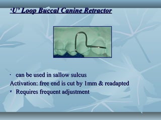 ‘‘U’ Loop Buccal Canine RetractorU’ Loop Buccal Canine Retractor
• can be used in sallow sulcuscan be used in sallow sulcus
Activation: free end is cut by 1mm & readaptedActivation: free end is cut by 1mm & readapted
 Requires frequent adjustmentRequires frequent adjustment
 