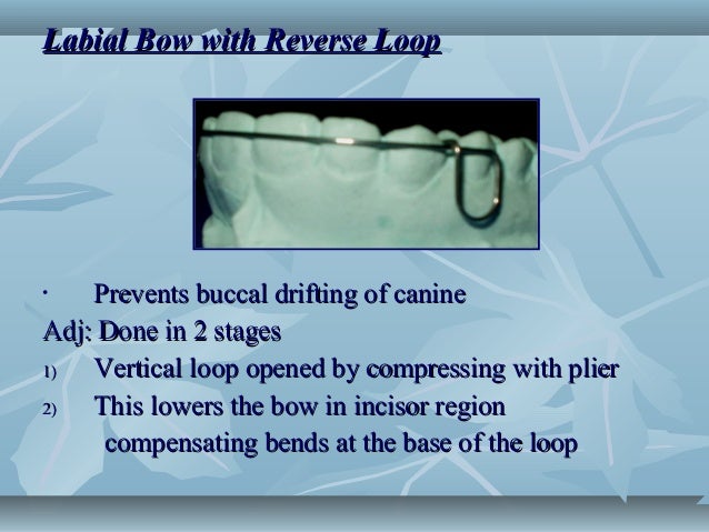 Basic removable appliance design