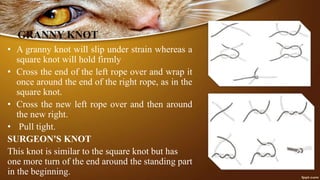 GRANNY KNOT
• A granny knot will slip under strain whereas a
square knot will hold firmly
• Cross the end of the left rope over and wrap it
once around the end of the right rope, as in the
square knot.
• Cross the new left rope over and then around
the new right.
• Pull tight.
SURGEON'S KNOT
This knot is similar to the square knot but has
one more turn of the end around the standing part
in the beginning.
 