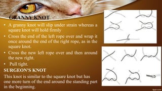 GRANNY KNOT
• A granny knot will slip under strain whereas a
square knot will hold firmly
• Cross the end of the left rope over and wrap it
once around the end of the right rope, as in the
square knot.
• Cross the new left rope over and then around
the new right.
• Pull tight.
SURGEON'S KNOT
This knot is similar to the square knot but has
one more turn of the end around the standing part
in the beginning.
 