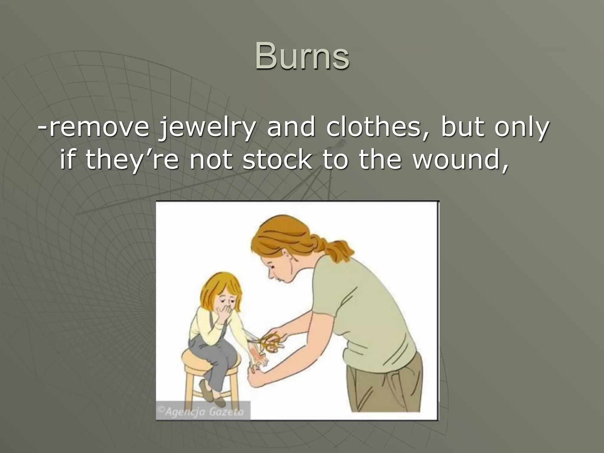 Burns
-remove jewelry and clothes, but only
  if they’re not stock to the wound,
 