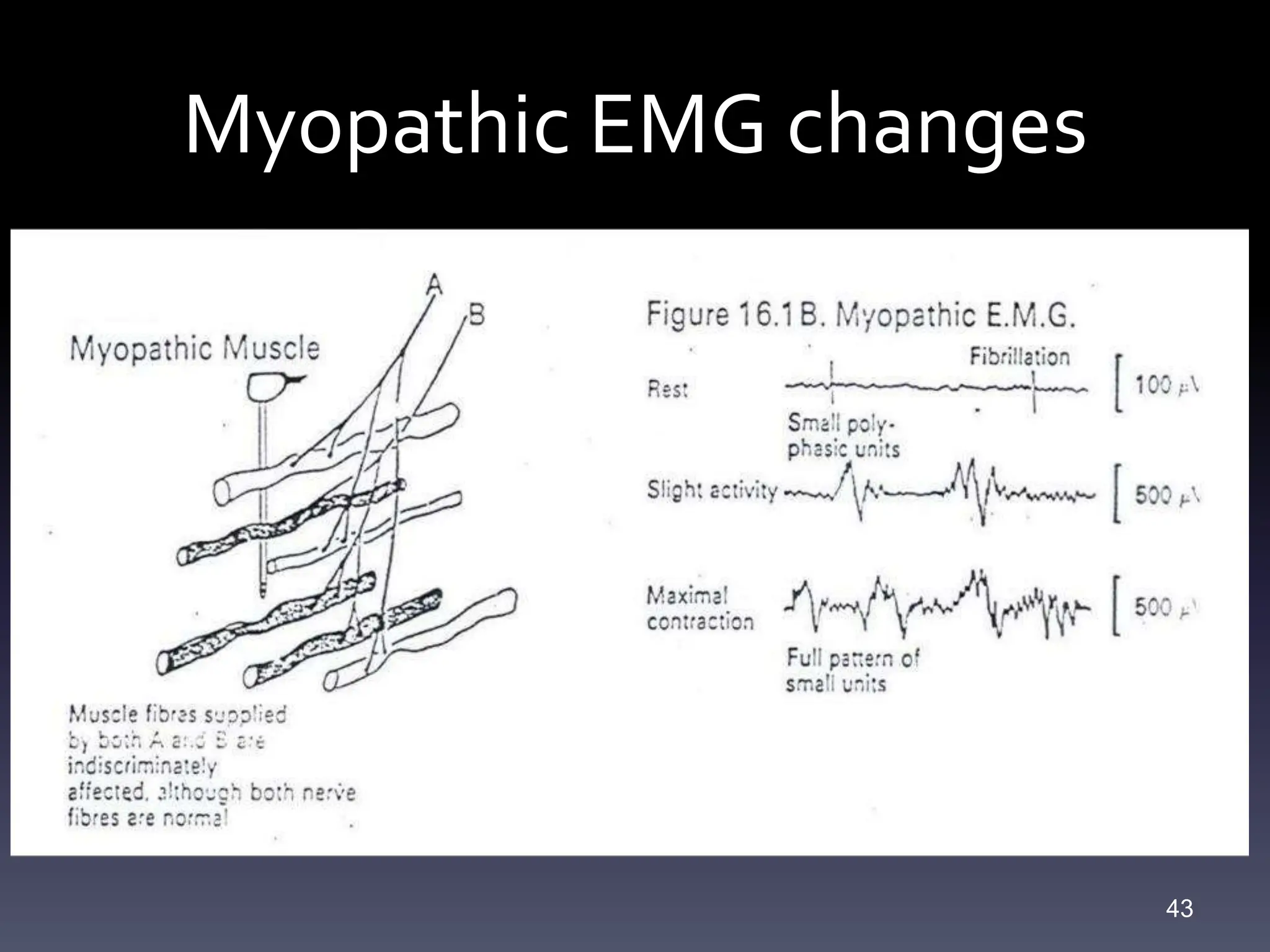 ncs study - basics of nerve conduction study | PPTX