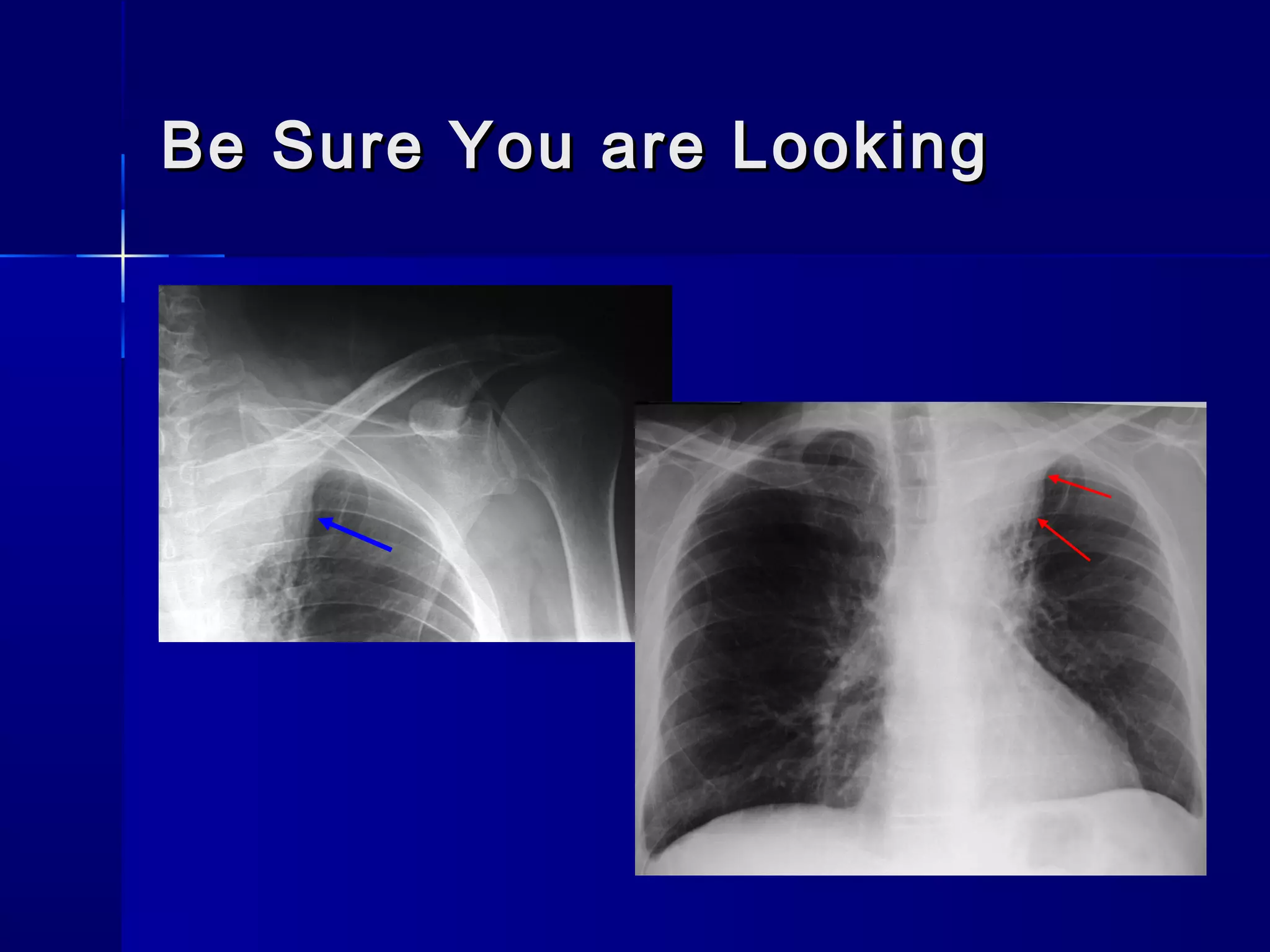 Be Sure You are LookingBe Sure You are Looking
 