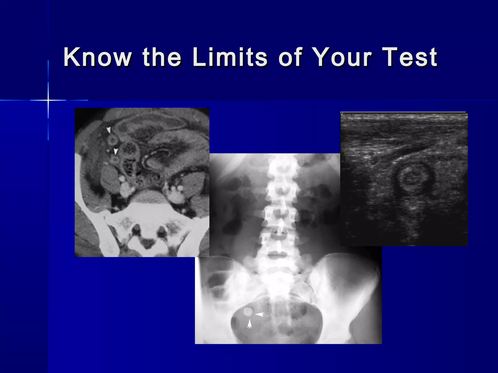 Know the Limits of Your TestKnow the Limits of Your Test
 