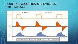 Basics and Clinical Application of Mechanical Ventilation | PPTX