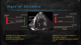 Angle of Incidence
Reflection from a tissue interface at
right angle. There is
stronger reflection resulting in brighter
echo.
Reflection at an angle equal to
the angle of incidence
producing less bright echo.
 