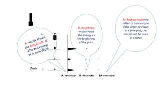 B- Brightness
mode shows
the energy as
the brightness
of the point
M- Motion mode the
reflector is moving so
if the depth is shown
in a time plot, the
motion will be seen
as a curve
A
B
C
 