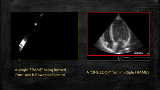 A single ‘FRAME’ being formed
from one full sweep of beams
A ‘CINE LOOP’ from multiple FRAMES
 