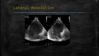 Lateral Resolution
 