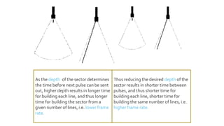 As the depth of the sector determines
the time before next pulse can be sent
out, higher depth results in longer time
for building each line, and thus longer
time for building the sector from a
given number of lines, i.e. lower frame
rate.
Thus reducing the desired depth of the
sector results in shorter time between
pulses, and thus shorter time for
building each line, shorter time for
building the same number of lines, i.e.
higher frame rate.
 
