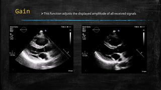 Gain This function adjusts the displayed amplitude of all received signals
 
