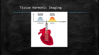 Tissue Harmonic Imaging
 