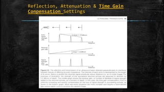 Reflection, Attenuation & Time Gain
Conpensation Settings
 