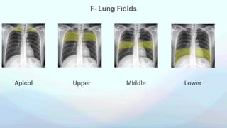 basics of chest xray with labelled diagram.pdf