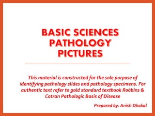 Prepared by: Anish Dhakal
This material is constructed for the sole purpose of
identifying pathology slides and pathology specimens. For
authentic text refer to gold standard textbook Robbins &
Cotran Pathologic Basis of Disease
 