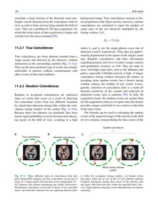 192                                                                                                                  M.M. Khalil

constitute a large fraction of the detected count rate.           background image. True coincidences increase in lin-
Singles can be detected from the coincidence ﬁeld of              ear proportion to the object activity; however, random
view as well as from activity lying outside the ﬁeld of           coincidences are estimated to equal the product of
view. They are a problem in 3D data acquisition, for              count rates of the two detectors multiplied by the
which the axial extent of data acquisition is larger and          timing window (2t):
extends over the area examined [58].
                                                                                         Rij ¼ 2t Sa Sb

11.3.1 True Coincidences                                          where Sa and Sb are the single-photon event rate of
                                                                  detectors a and b, respectively. Thus, they are approx-
True coincidences are those photons emitted from a                imately proportional to the square of the singles count
single nuclei and detected by the detectors without               rate. Random coincidences add false information
interactions in the surrounding medium (Fig. 11.11a).             regarding position and serve to reduce image contrast
They are the most preferred type of events not actually           and quantitative accuracy as well. They are large in
achievable in practice without contamination with                 areas with high count rates, such as the abdomen and
other events (scatter and randoms).                               pelvis, especially if bladder activity is high. A longer
                                                                  coincidence timing window increases the chance of
                                                                  accepting more random events, but a shorter timing
                                                                  window reduces the number of true events. Conse-
11.3.2 Random Coincidences                                        quently, selection of coincidence time is a trade-off
                                                                  between sensitivity of the scanner and reduction of
Random or accidental coincidences are undesired                   undesired events such as randoms [59]. In fully 3D
types of events that occur as a result of detecting               acquisition mode, the random events are greater than
two coincident events from two different locations                for 2D acquisition (with use of septa) since the former
by which their detection timing falls within the coin-            provides a larger axial ﬁeld of view relative to the ﬁeld
cidence timing window of the system (Fig. 11.11b).                of the true events.
Because these two photons are unrelated, they have                   The formula can be used in estimating the random
nearly equal probability to occur between most decay-             events in the acquired images if the activity in the ﬁeld
ing nuclei in the ﬁeld of view, resulting in a high               of view remains constant during the time course of the

                                                                                        Scatter coincidence

a                                b                                 c
       True coincidence                Random coincidence




                                                                                       White circles indicate
                                                                                              scatter

Fig. 11.11 Three different types of coincidences that take        is within the acceptance timing window. (c) Scatter events
place during PET imaging. (a) True coincidence occurs due to      take place when one or two of the 511 keV photons undergo
decay of a single nuclei and emission of two antiparallel 511     Compton interaction during their travel to the detector pair
keV photons and without undergoing any further interactions.      and again with detection time within the speciﬁed limit; how
(b) Random coincidence occurs due to decay of two unrelated       ever, single photon scattering is more abundant than two photon
nuclei such that their detection by two opposing detector pairs   scattering
 