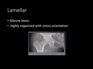 Lamellar
• Mature bone
• highly organized with stress orientation
 