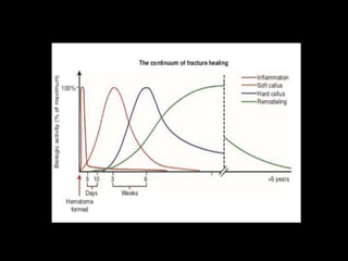 Basic science in Orthopaedic