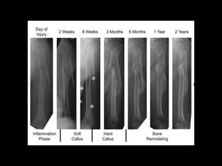 Basic science in Orthopaedic