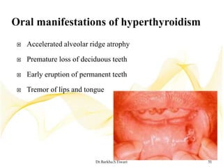 Thyroid and parathyroid glands | PPTX