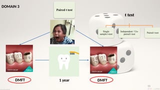 55
t test
Single
sample t-test
Independent / Un-
paired t test
Paired t test
DOMAIN 3
Paired t test
DMFT 1 year DMFT
 