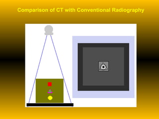 Comparison of CT with Conventional Radiography 