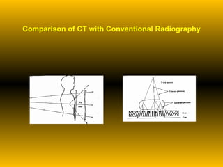 Comparison of CT with Conventional Radiography 