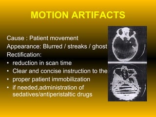 MOTION ARTIFACTS Cause : Patient movement  Appearance: Blurred / streaks / ghost images Rectification:  reduction in scan time Clear and concise instruction to the patient   proper patient immobilization if needed,administration of sedatives/antiperistaltic drugs 
