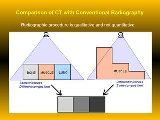 Comparison of CT with Conventional Radiography Radiographic procedure is qualitative and not quantitative 