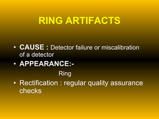 RING ARTIFACTS CAUSE :   Detector failure or miscalibration of a detector APPEARANCE:- Ring Rectification : regular quality assurance checks 