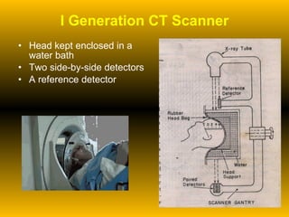 I Generation CT Scanner Head kept enclosed in a water bath Two side-by-side detectors A reference detector 