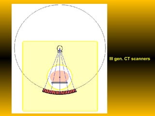 III gen. CT scanners 