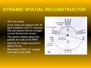 DYNAMIC SPATIAL RECONSTRUCTOR 28 X-ray tubes X-ray tubes are aligned with 28 light amplifiers and TV cameras that are placed behind a single curved fluorescent screen The gantry rotates about the patient at a rate of 50 RPM Data for an image acquired in about 16 ms. Reconstruct 250 C.S. images from each scan data 