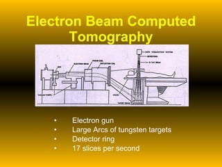 Electron Beam Computed Tomography Electron gun Large Arcs of tungsten targets Detector ring 17 slices per second 