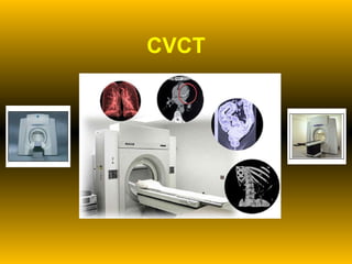 CVCT 