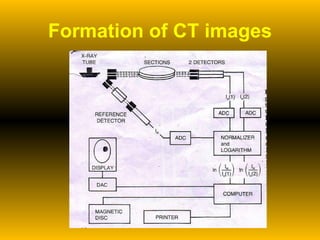 Formation of CT images 