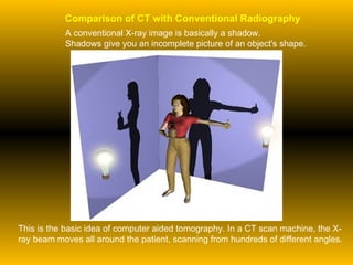 This is the basic idea of computer aided tomography. In a CT scan machine, the X-ray beam moves all around the patient, scanning from hundreds of different angles. Comparison of CT with Conventional Radiography A conventional X-ray image is basically a shadow. Shadows give you an incomplete picture of an object's shape. 
