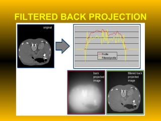 FILTERED BACK PROJECTION 